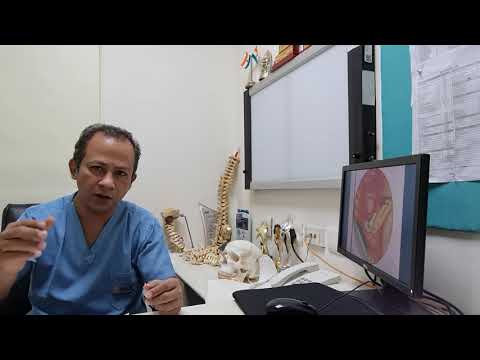 Spine Surgery Procedure| Best Spine Surgeon in Uttar Pradesh| Dr Yashpel Bundela