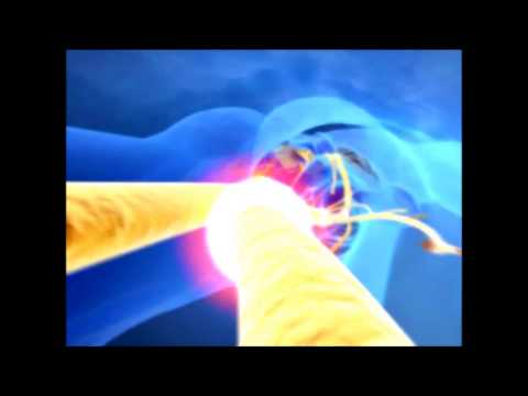 Root Anatomy Procedure