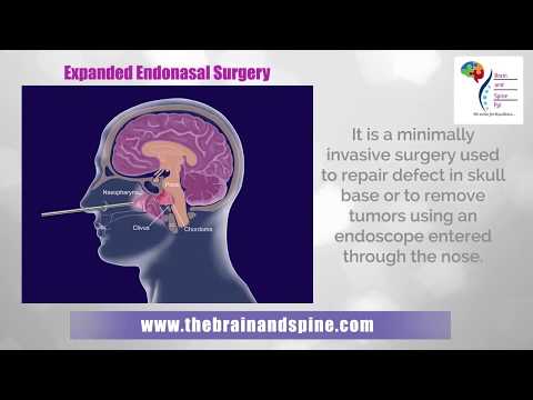 Neurological Disease and Disorder Treatment in Delhi | Neurosurgeon in Uttar Pradesh, India